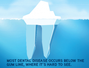 dental disease tip of  the iceburg